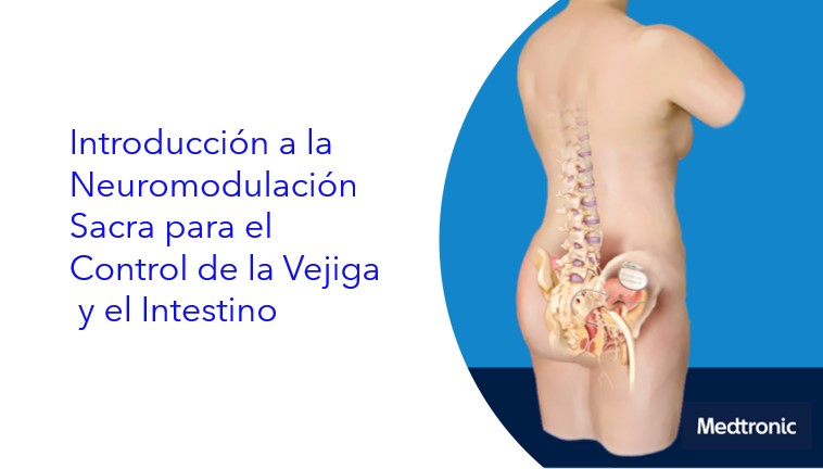 Introducción a la Neuromodulación Sacra para el Control de la Vejiga y el Intestino
