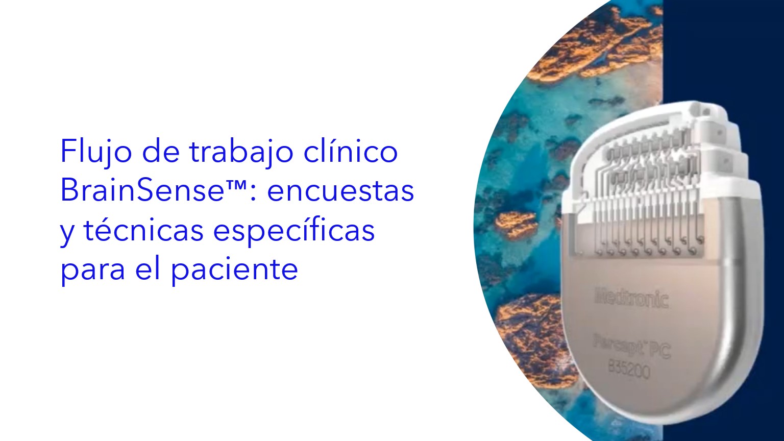 Flujo de trabajo clínico BrainSense™: encuestas y técnicas específicas para el paciente . | Fluxo de trabalho clínico BrainSense™: pesquisa e técnicas específicas do paciente .