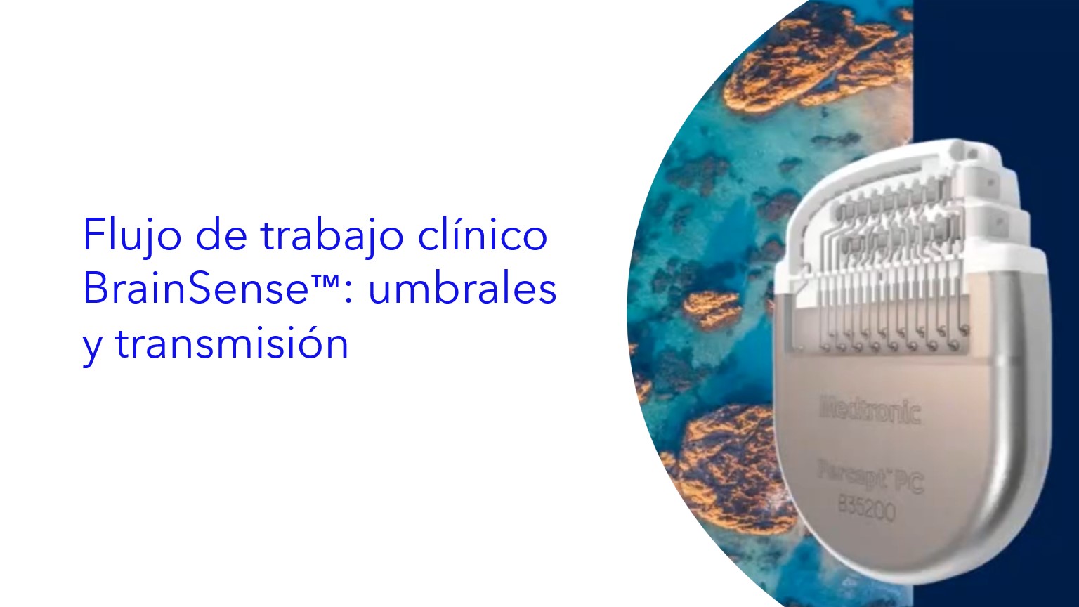 Flujo de trabajo clínico BrainSense™: umbrales y transmisión