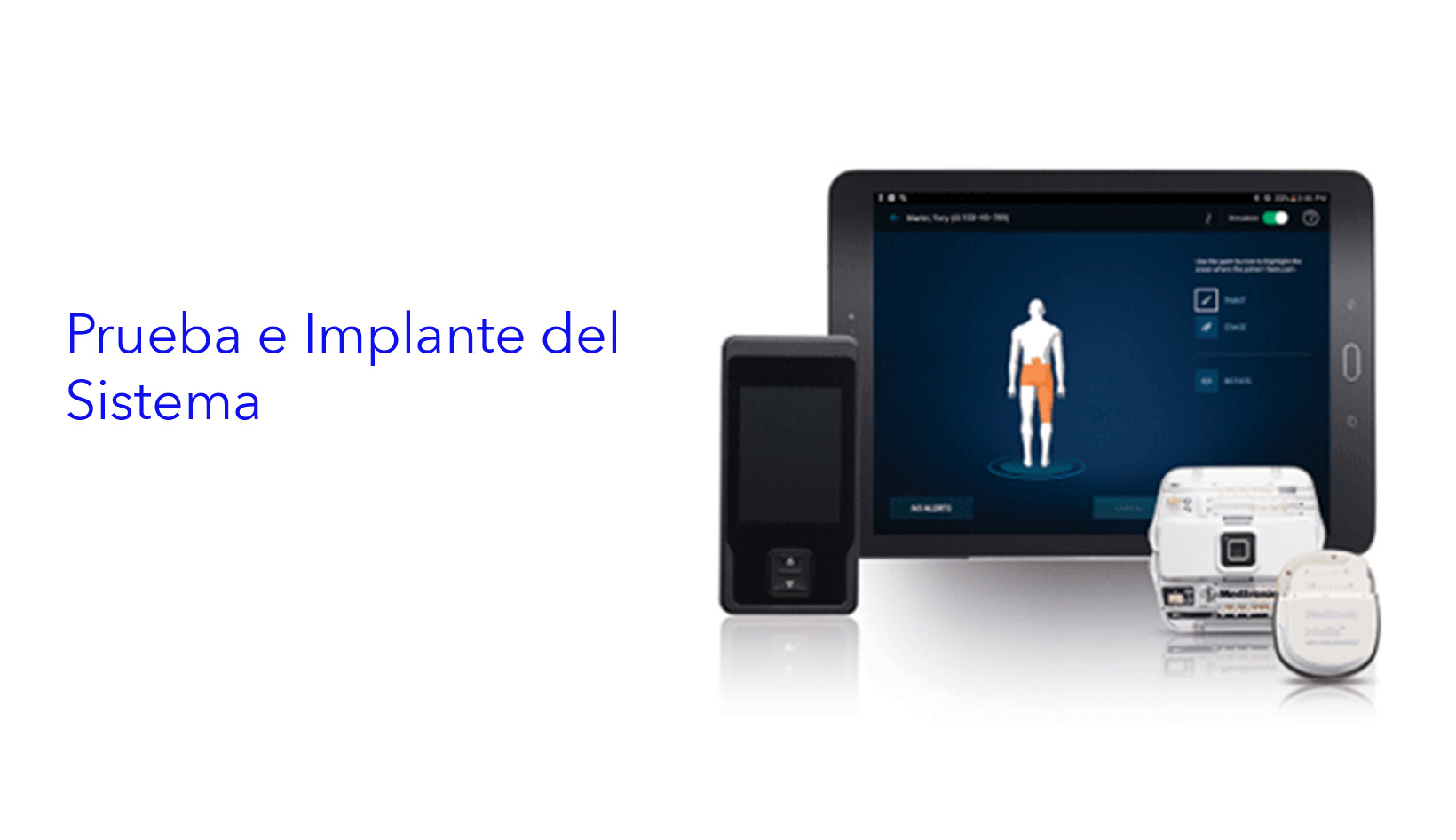 Prueba e Implante del Sistema.